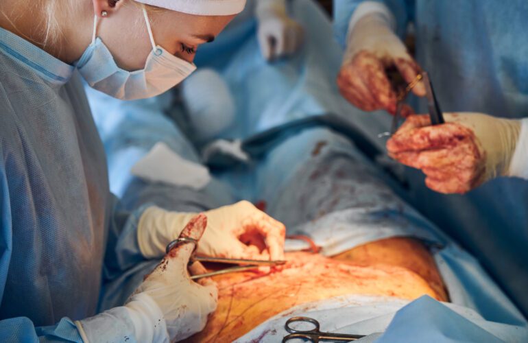 Gynecological laparoscopy