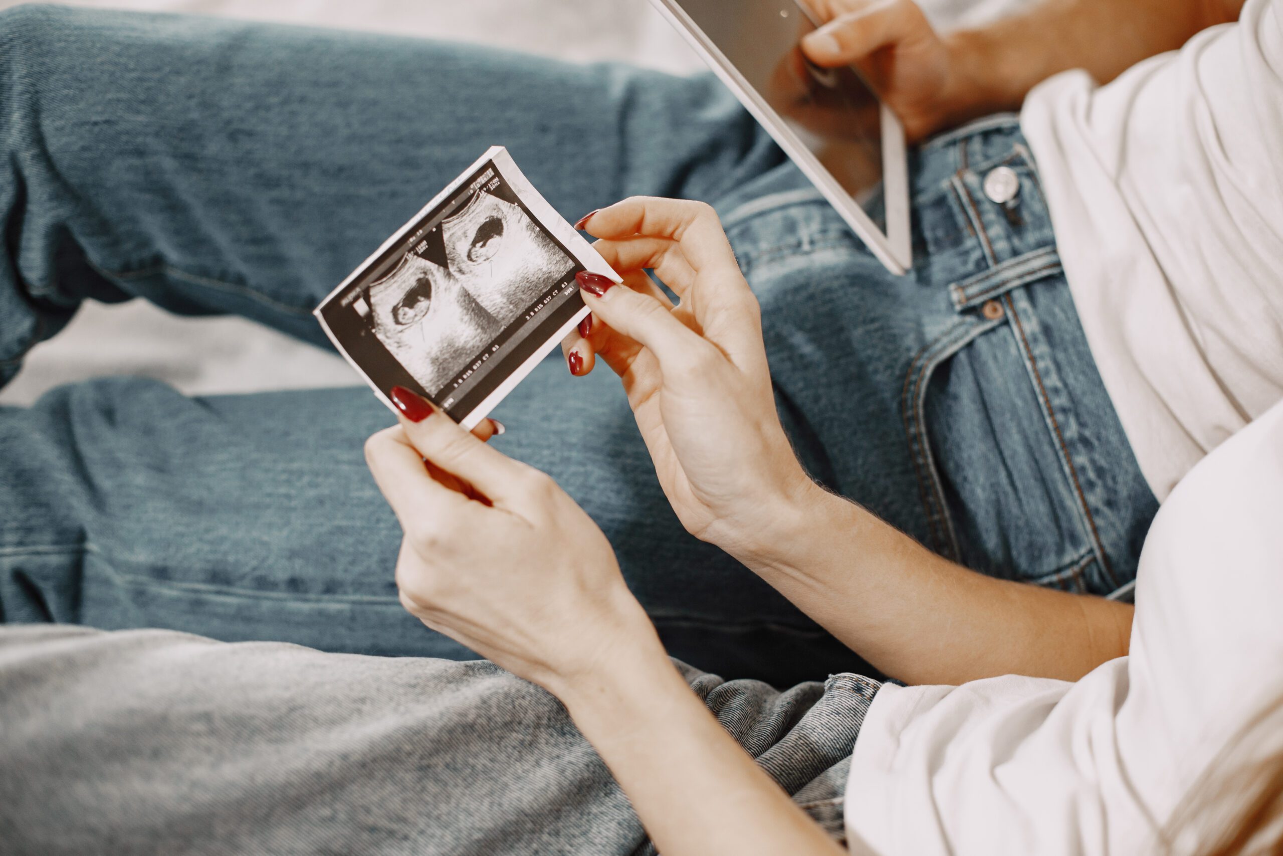 Fertility Treatment in Kochi