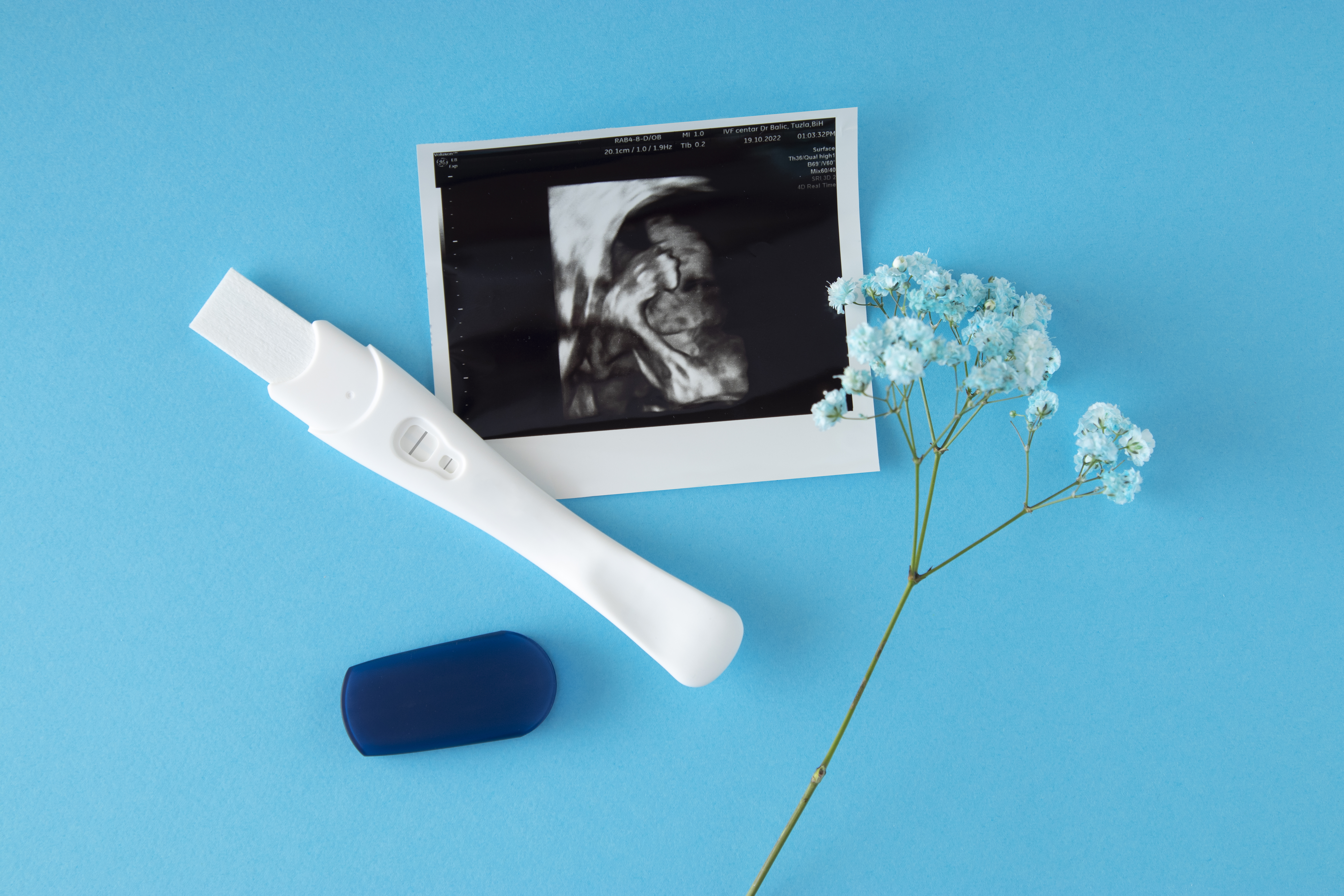 Low-Cost IVF Treatment Center in Kochi