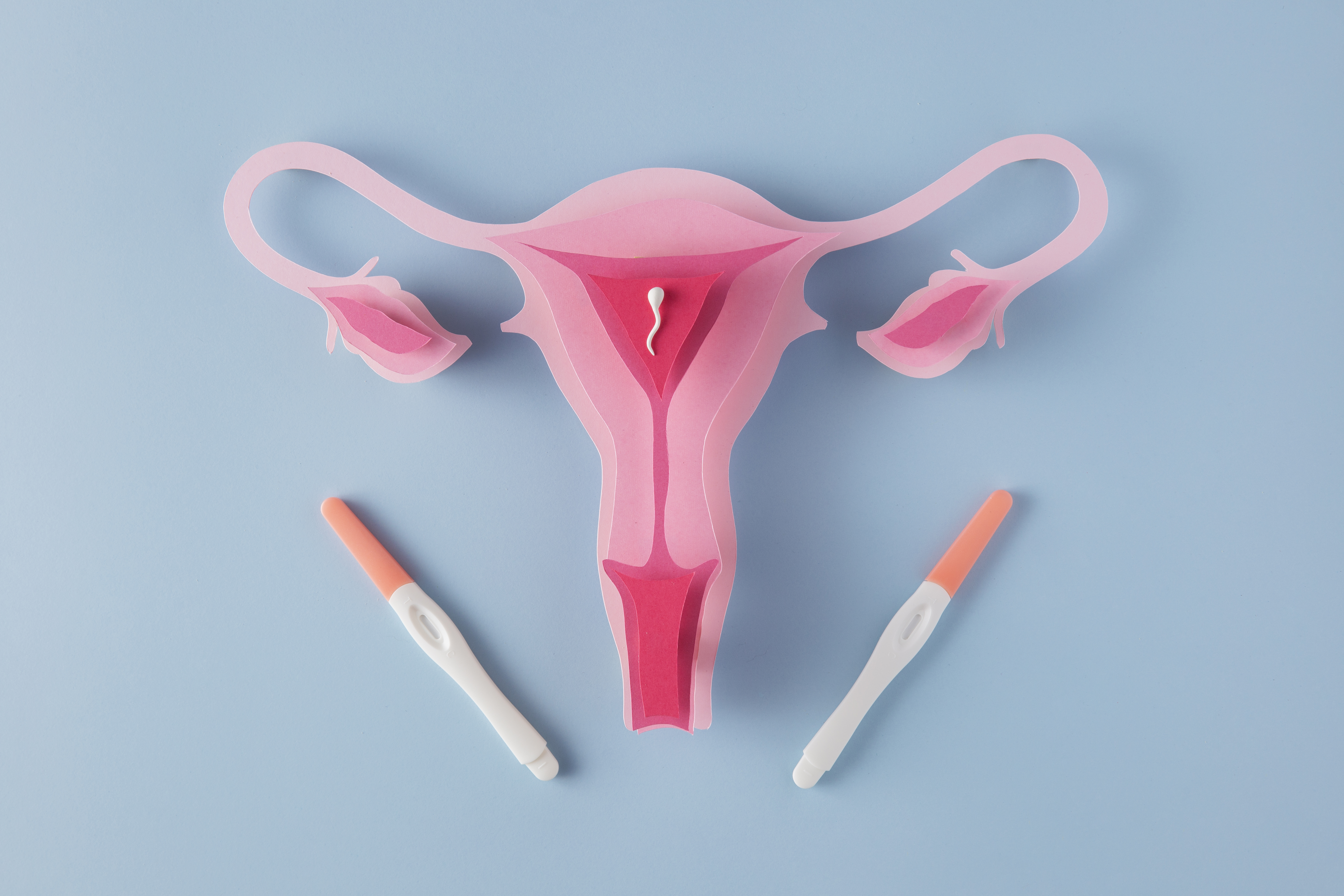 IUI