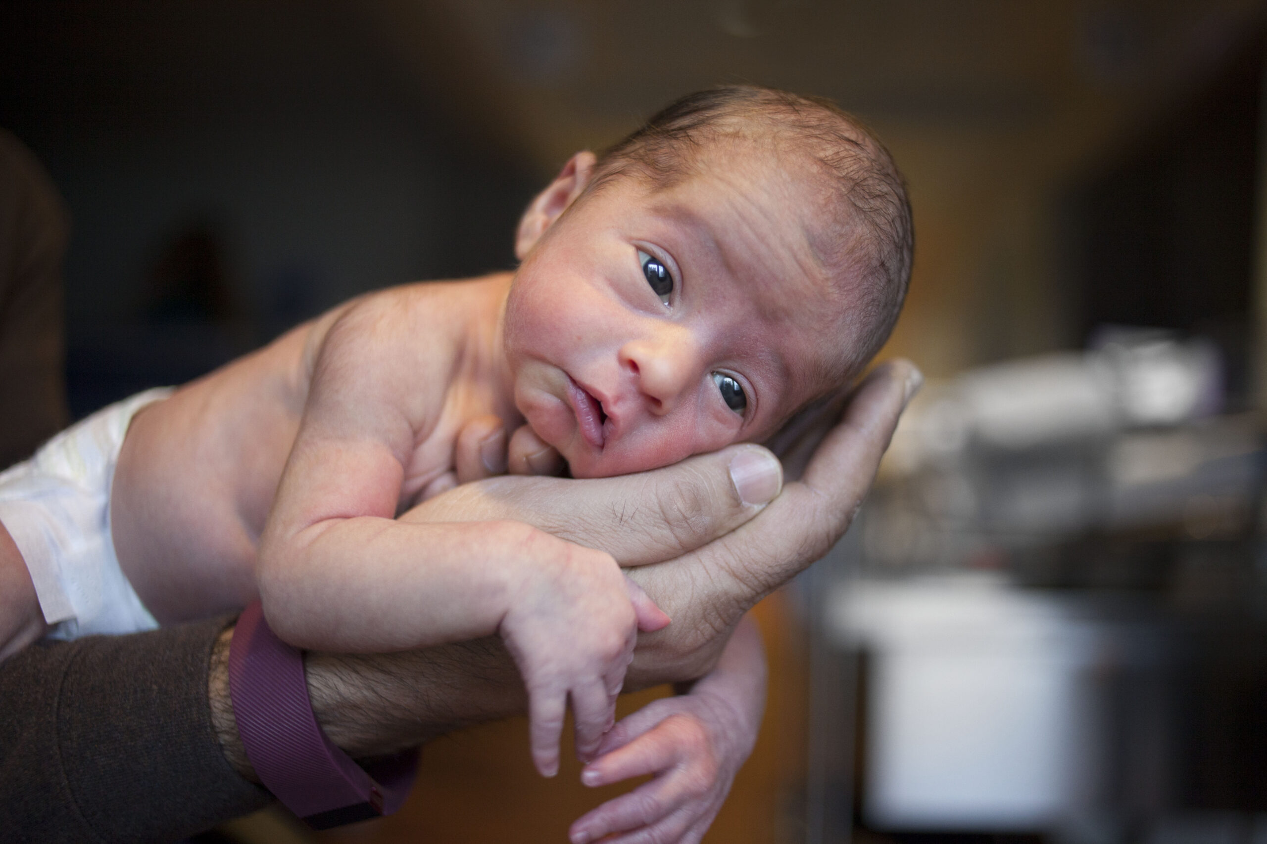 birth defects