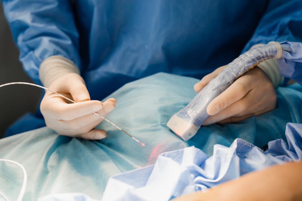 gynaec Laparoscopy in infertility