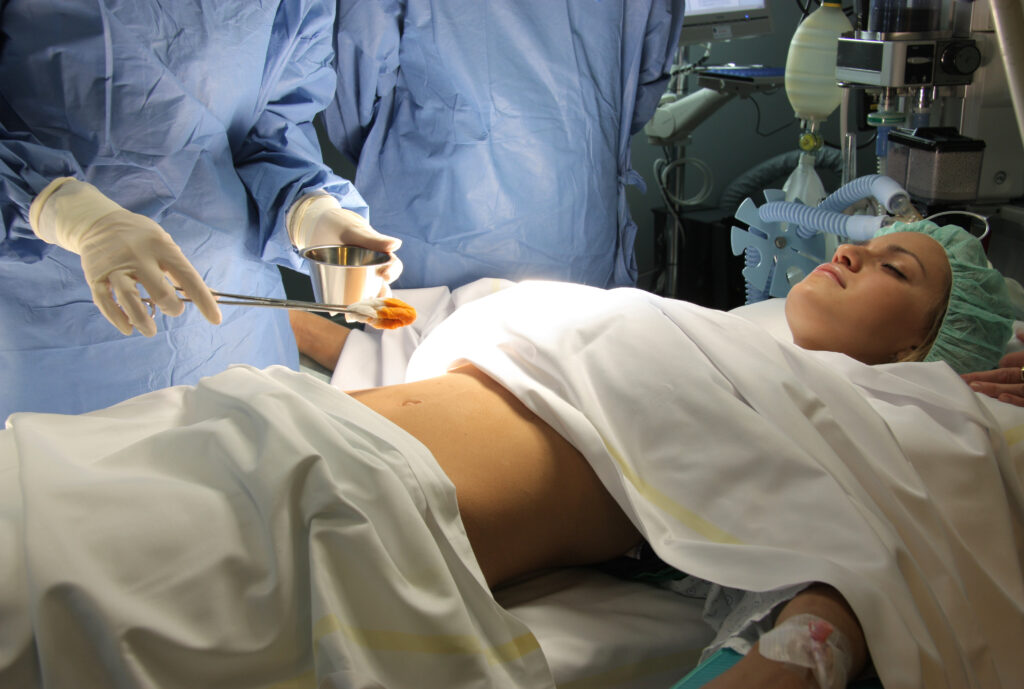 gynaec Laparoscopy in fertility