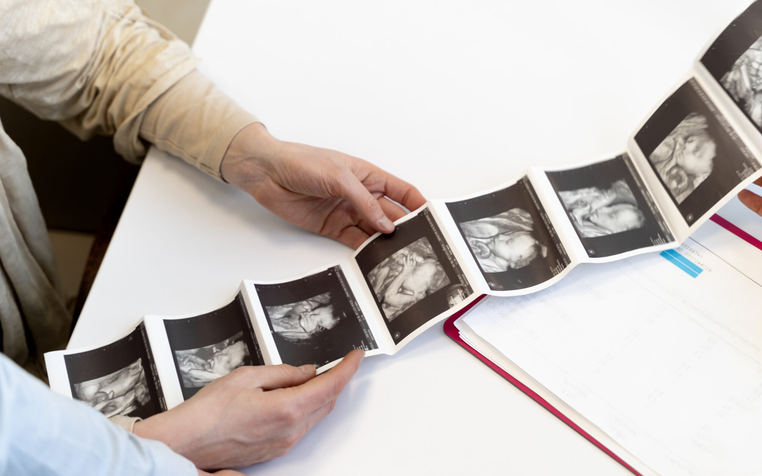 embryo images