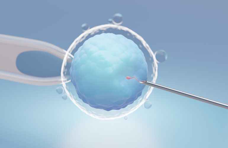 Natural IVF cycle
