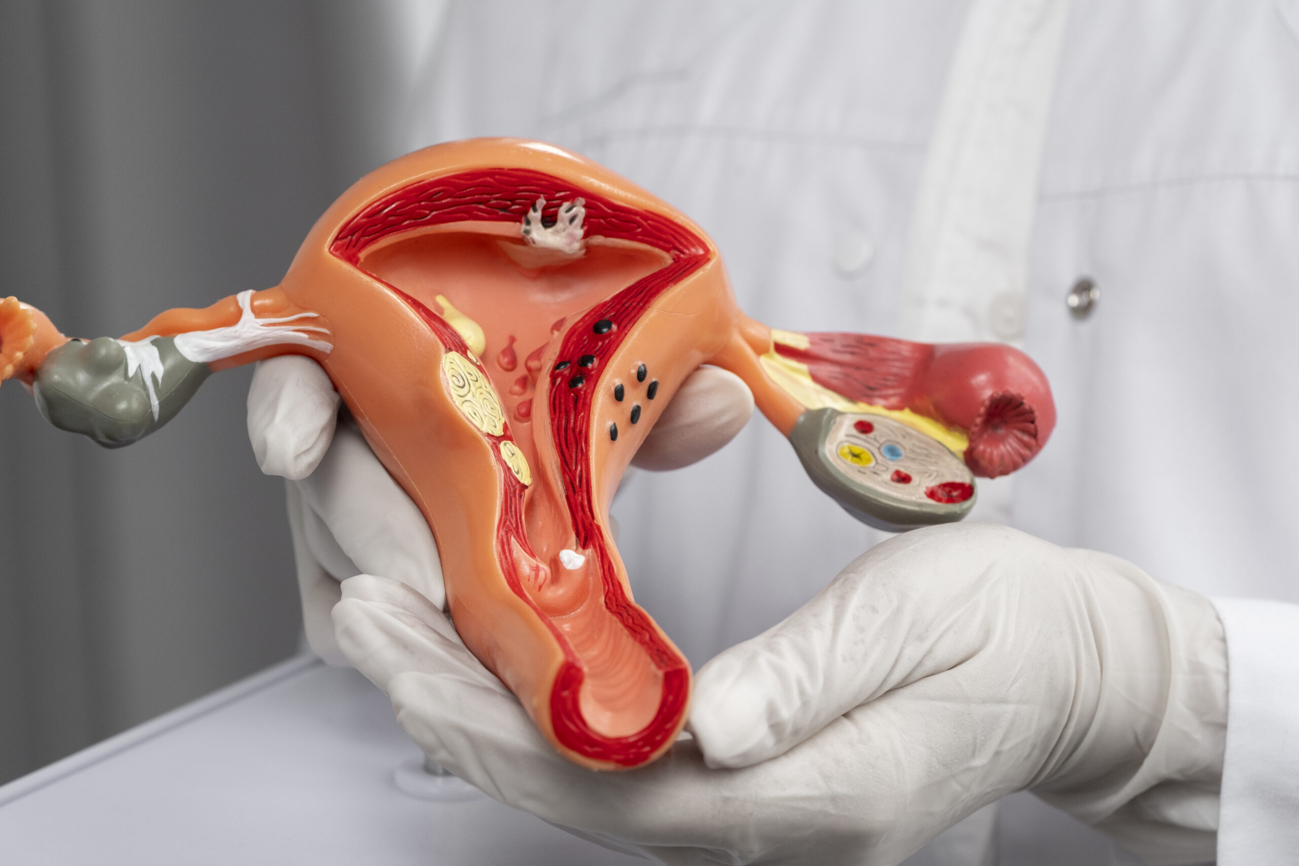 Blocked Fallopian Tubes