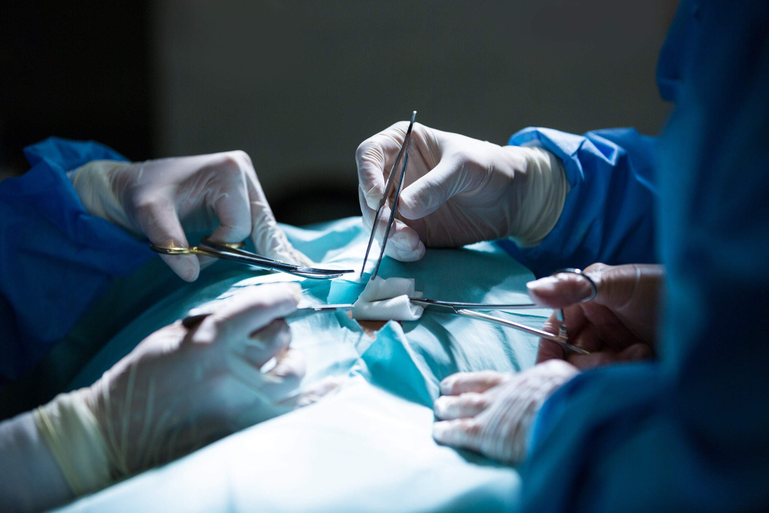 Laparoscopic tubal ligation