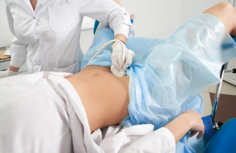 Total Laparoscopic Hysterectomy
