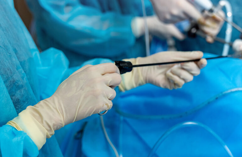 Laparoscopic Surgery Cost for Infertility