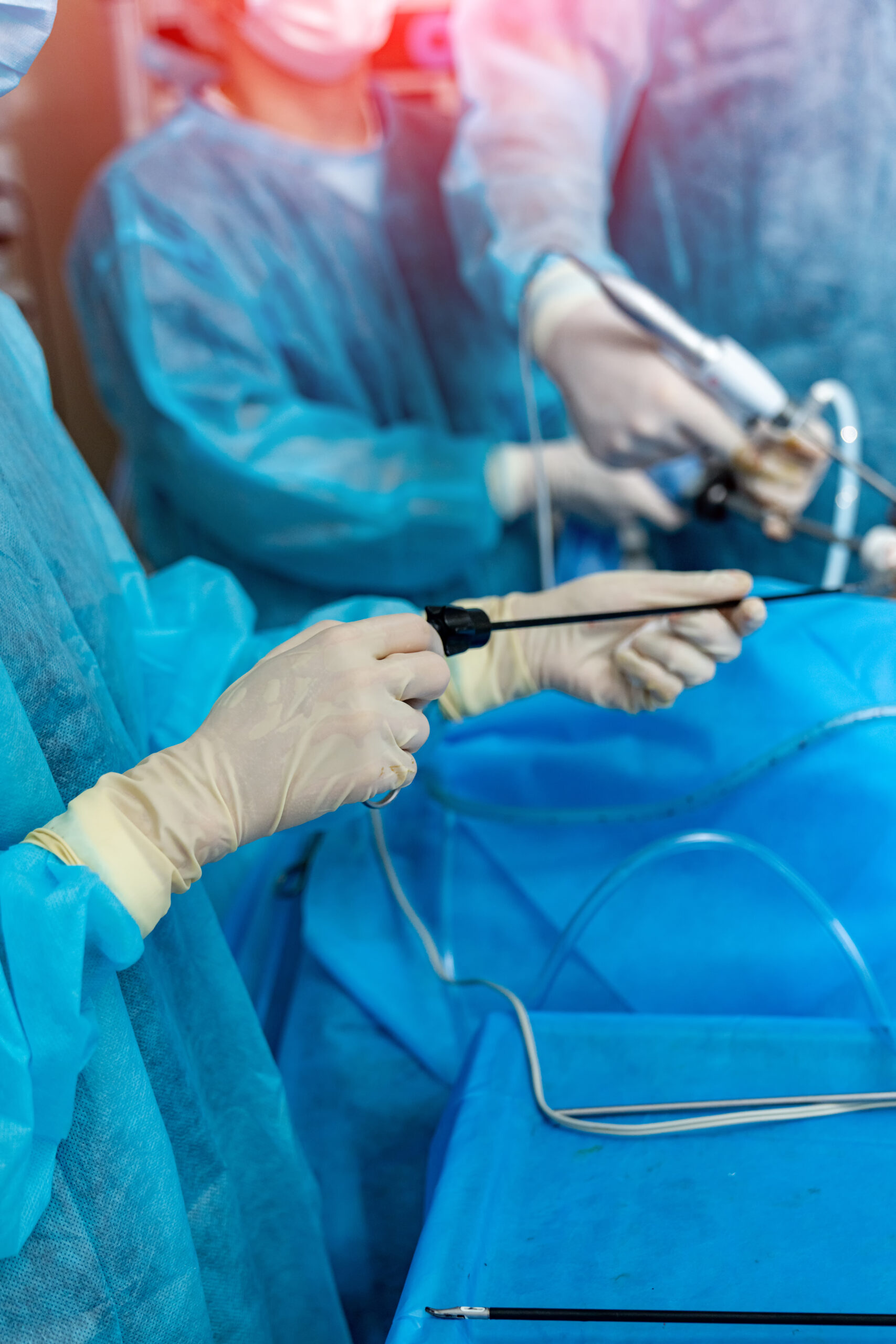 Laparoscopic Surgery Cost for Infertility